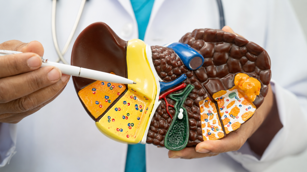 Fatty Liver (MASLD) Diet and Reversal